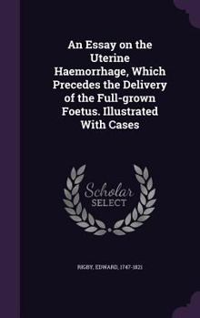 Hardcover An Essay on the Uterine Haemorrhage, Which Precedes the Delivery of the Full-grown Foetus. Illustrated With Cases Book