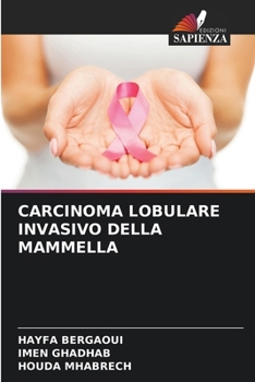Paperback Carcinoma Lobulare Invasivo Della Mammella [Italian] Book