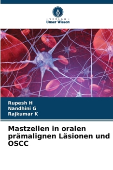Paperback Mastzellen in oralen prämalignen Läsionen und OSCC [German] Book