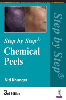 Paperback Step by Step: Chemical Peels Book