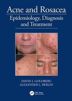 Hardcover Acne and Rosacea: Epidemiology, Diagnosis and Treatment Book