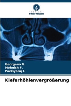 Paperback Kieferhöhlenvergrößerung [German] Book