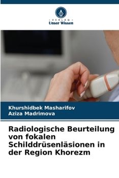 Radiologische Beurteilung von fokalen Schilddrüsenläsionen in der Region Khorezm (German Edition)