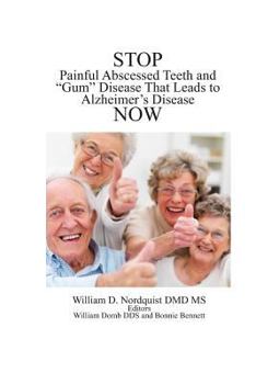 Paperback Stop Painful Abscessed Teeth and Gum Disease that Leads to Alzheimer's Now. Book