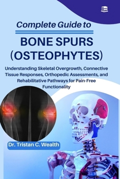 COMPLETE GUIDE TO BONE SPURS (OSTEOPHYTES): Understanding Skeletal Overgrowth, Connective Tissue Responses, Orthopedic Assessments, and Rehabilitative Pathways for Pain-Free Functionality