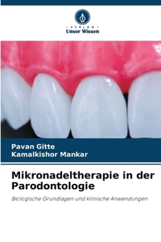 Paperback Mikronadeltherapie in der Parodontologie [German] Book
