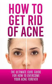 Paperback How to Get Rid of Acne: The Ultimate Cure Guide for How to Overcome Your Acne Forever Book