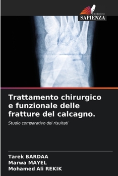 Paperback Trattamento chirurgico e funzionale delle fratture del calcagno. [Italian] Book