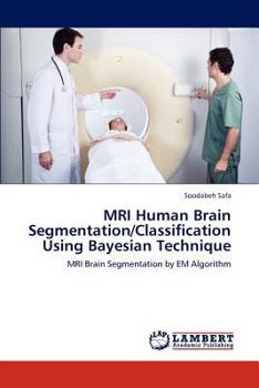 Paperback MRI Human Brain Segmentation/Classification Using Bayesian Technique Book