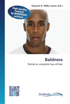 Paperback Baldness Book