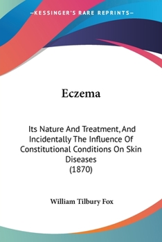 Paperback Eczema: Its Nature And Treatment, And Incidentally The Influence Of Constitutional Conditions On Skin Diseases (1870) Book