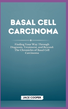 Paperback Basal Cell Carcinoma: Finding Your Way Through Diagnosis, Treatment, and Beyond: The Chronicles of Basal Cell Carcinoma Book