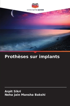 Paperback Prothèses sur implants [French] Book