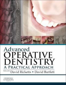 Paperback Advanced Operative Dentistry: A Practical Approach Book