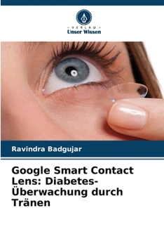 Paperback Google Smart Contact Lens: Diabetes-Überwachung durch Tränen [German] Book