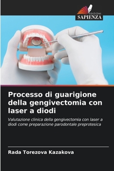 Paperback Processo di guarigione della gengivectomia con laser a diodi [Italian] Book