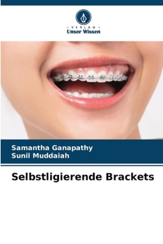 Paperback Selbstligierende Brackets [German] Book