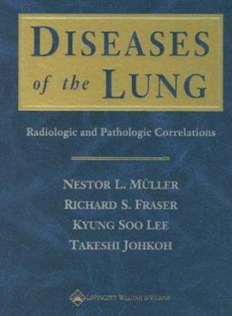 Hardcover Diseases of the Lung: Radiologic and Pathologic Correlations Book