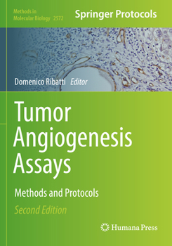 Paperback Tumor Angiogenesis Assays: Methods and Protocols Book