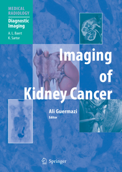 Hardcover Imaging of Kidney Cancer Book