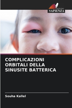 Paperback Complicazioni Orbitali Della Sinusite Batterica [Italian] Book