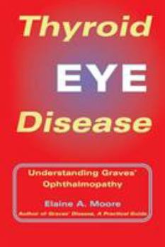 Paperback Thyroid Eye Disease: Understanding Graves' Ophthalmopathy Book