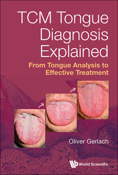 Hardcover Tcm Tongue Diagnosis Explained: From Tongue Analysis to Effective Treatment Book