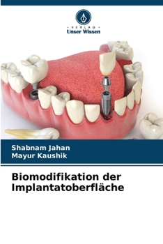 Biomodifikation der Implantatoberfläche (German Edition)