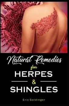 Paperback Natural Remedies For HERPES & SHINGLES: The Complete Guide Book