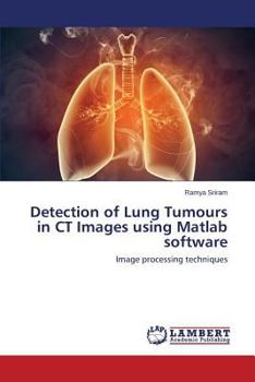 Paperback Detection of Lung Tumours in CT Images using Matlab software Book