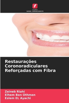 Paperback Restaurações Coronoradiculares Reforçadas com Fibra [Portuguese] Book