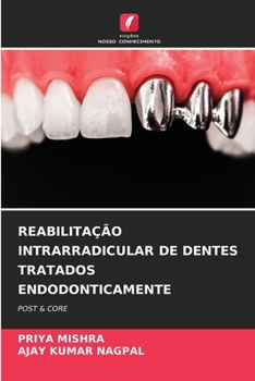 REABILITAÇÃO INTRARRADICULAR DE DENTES TRATADOS ENDODONTICAMENTE: POST & CORE