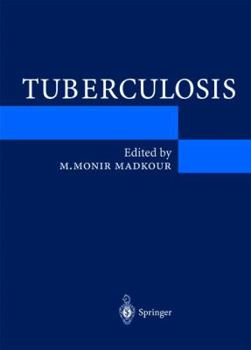 Tuberculosis