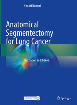 Hardcover Anatomical Segmentectomy for Lung Cancer: Illustration and Videos Book
