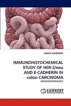 Paperback IMMUNOHISTOCHEMICAL STUDY OF HER-2/neu AND E-CADHERIN IN colon CARCINOMA Book