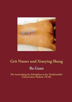 Paperback Ba Guan: Die Anwendung des Schröpfens in der Traditionellen Chinesischen Medizin (TCM) [German] Book