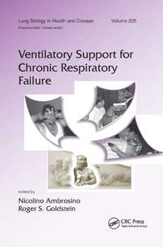 Paperback Ventilatory Support for Chronic Respiratory Failure Book