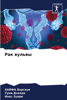 Paperback Рак вульвы [Russian] Book