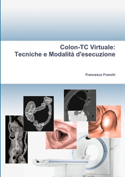 Paperback Colon-TC Virtuale: Tecniche e Modalità d'esecuzione [Italian] Book