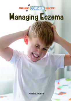 Managing Eczema