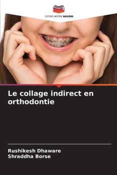 Le collage indirect en orthodontie (French Edition)