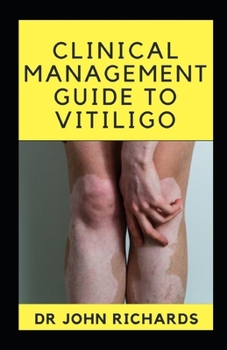 Paperback Clinical Management Guide To Vitiligo: Guide To Vitiligo Book