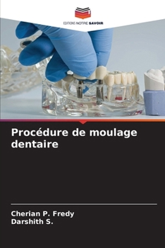 Procédure de moulage dentaire (French Edition)