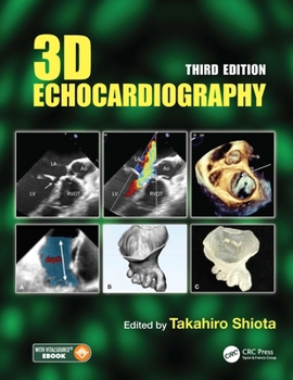 Hardcover 3D Echocardiography Book