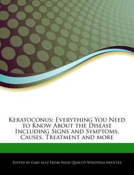 Paperback Keratoconus: Everything You Need to Know about the Disease Including Signs and Symptoms, Causes, Treatment and More Book