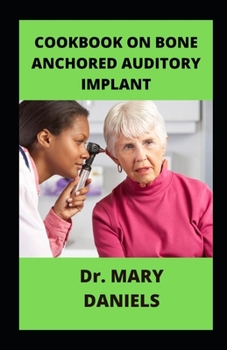 Paperback Cookbook On Bone Anchored Auditory Implant: Supreme Guidance on BAHA Book