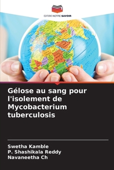Paperback Gélose au sang pour l'isolement de Mycobacterium tuberculosis [French] Book
