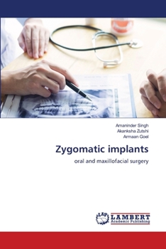 Paperback Zygomatic implants Book
