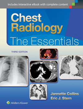 Hardcover Chest Radiology: The Essentials Book