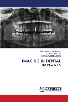 Paperback Imaging in Dental Implants Book